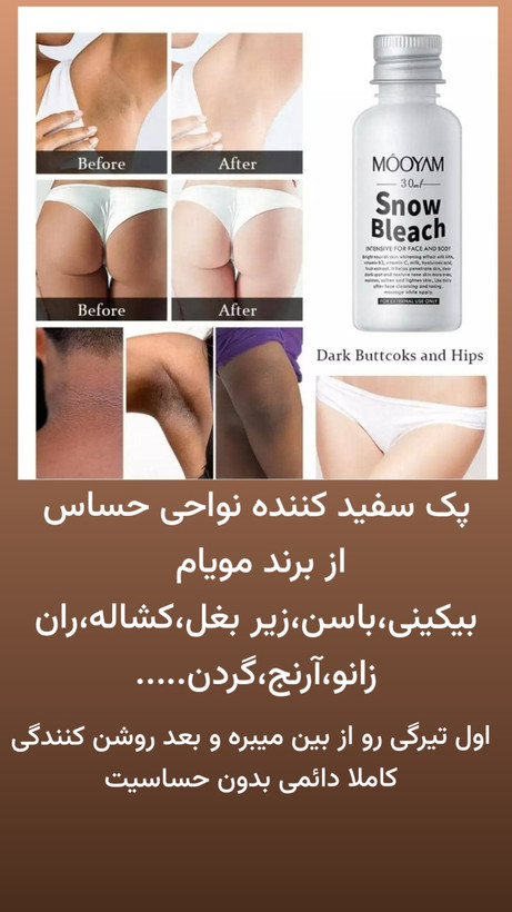 پک رفع تیرگی و سفیدی نواحی حساس