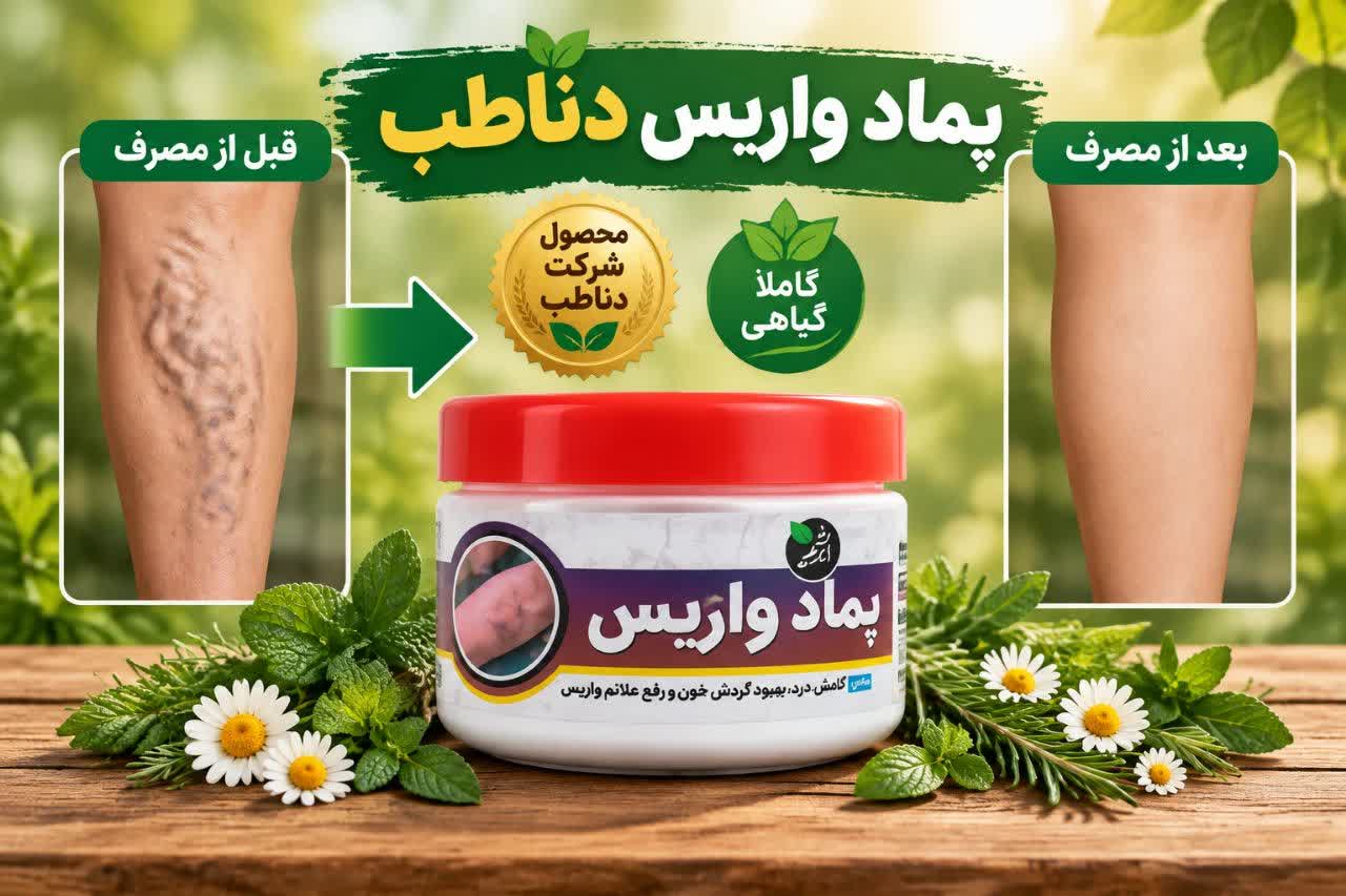 درمان واریس
